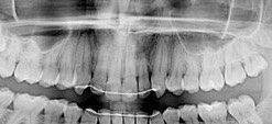 Caso clinico radiografie