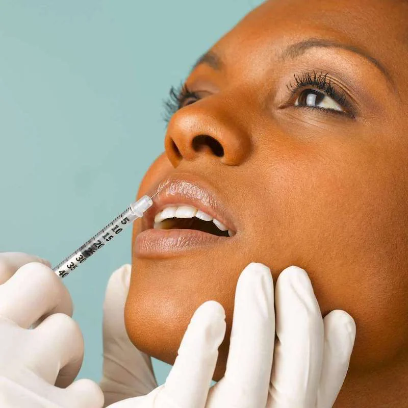 Come Funziona Il Trattamento Con Filler