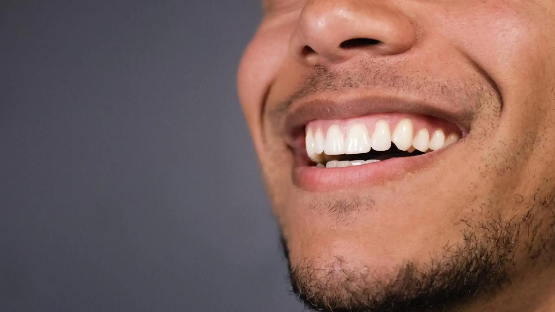 Le mascherine Invisalign Milano