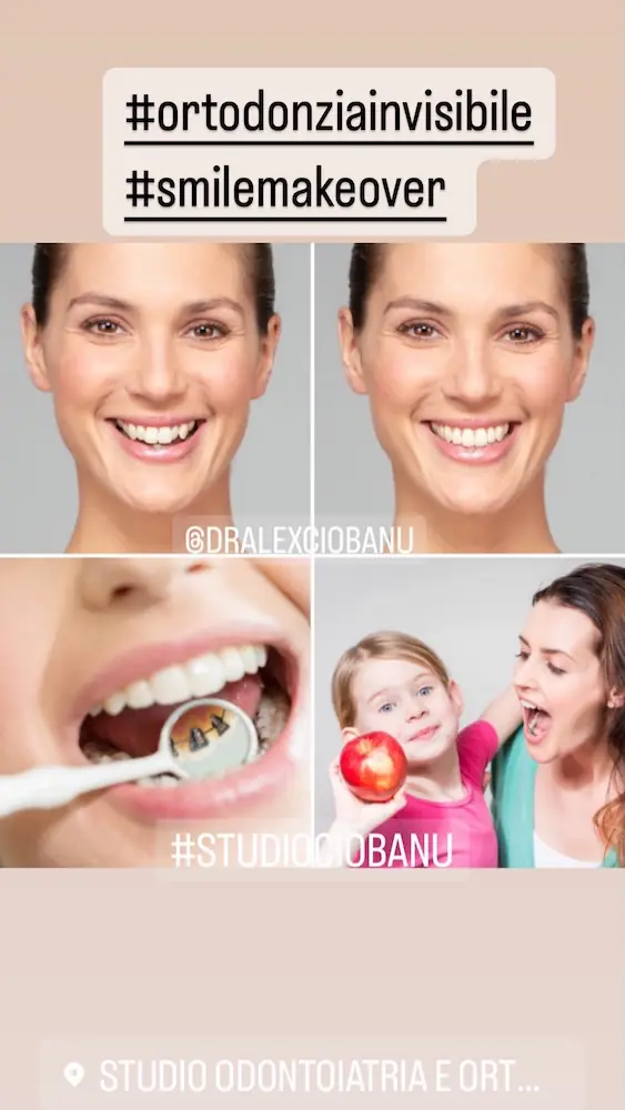 Allineatori Invisibili Prima e Dopo